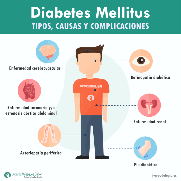 Diabetes Mellitus Tipos Causas Y Complicaciones Podología Jvg 7691