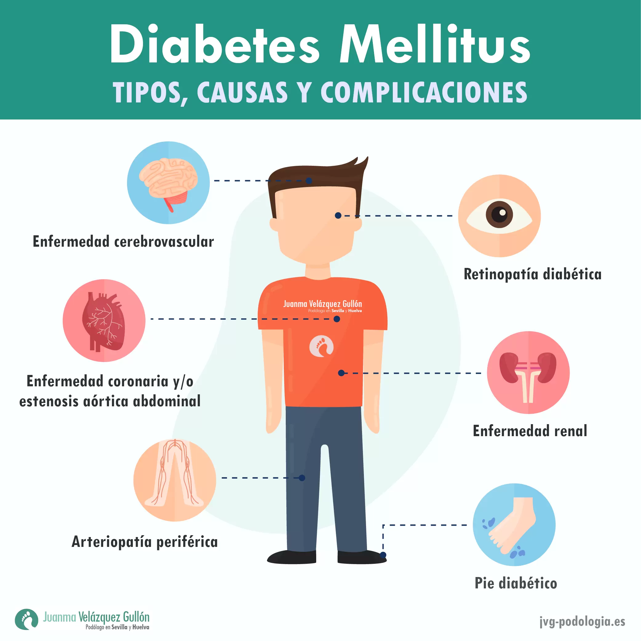 Diabetes Mellitus - Podología JVG